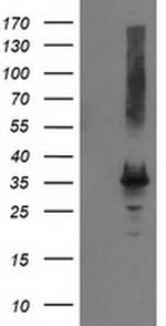 PYCR2 Antibody in Western Blot (WB)