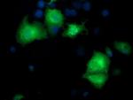 PYCRL Antibody in Immunocytochemistry (ICC/IF)