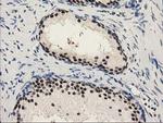PYCRL Antibody in Immunohistochemistry (Paraffin) (IHC (P))
