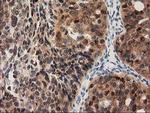 PYCRL Antibody in Immunohistochemistry (Paraffin) (IHC (P))