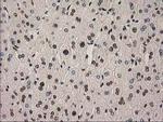 PYCRL Antibody in Immunohistochemistry (Paraffin) (IHC (P))