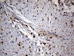 PYGM Antibody in Immunohistochemistry (Paraffin) (IHC (P))