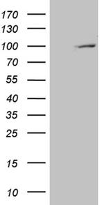 PYGM Antibody in Western Blot (WB)