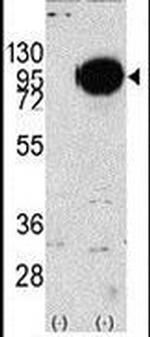 PYGM Antibody in Western Blot (WB)