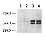 Cytokeratin Pan Type I/II Antibody in Western Blot (WB)