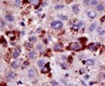 Pan SUMO Antibody in Immunohistochemistry (IHC)