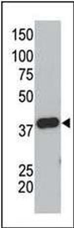 Pan SUMO Antibody in Western Blot (WB)