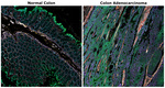 Pan Cytokeratin Antibody in Immunohistochemistry (Paraffin) (IHC (P))