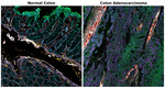 Collagen IV Antibody in Immunohistochemistry (Paraffin) (IHC (P))