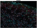 Collagen IV Antibody in Immunohistochemistry (Paraffin) (IHC (P))