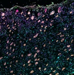 Collagen IV Antibody in Immunohistochemistry (Paraffin) (IHC (P))