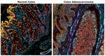 Alpha-Smooth Muscle Actin Antibody in Immunohistochemistry (Paraffin) (IHC (P))