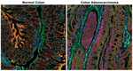 Collagen IV Antibody in Immunohistochemistry (Paraffin) (IHC (P))