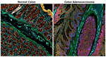 Alpha-Smooth Muscle Actin Antibody in Immunohistochemistry (Paraffin) (IHC (P))