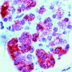 PTH1R Antibody in Immunohistochemistry (IHC)