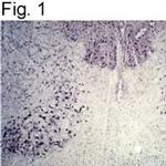 Parkin Polyclonal Antibody