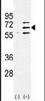 PARP6 Antibody in Western Blot (WB)