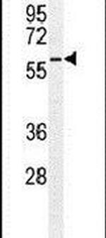 PARP6 Antibody in Western Blot (WB)