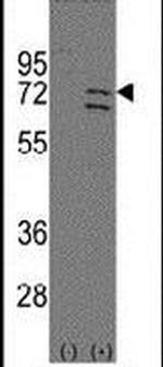 PARP6 Antibody in Western Blot (WB)