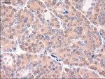 Patched1 Antibody in Immunohistochemistry (Paraffin) (IHC (P))