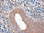 Patched1 Antibody in Immunohistochemistry (Paraffin) (IHC (P))