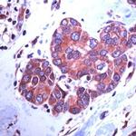 Paxillin Antibody in Immunohistochemistry (IHC)