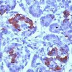 PMP22 Antibody in Immunohistochemistry (IHC)