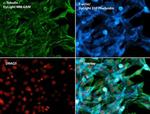 Phalloidin Control in Immunocytochemistry (ICC/IF)