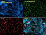 Phalloidin Control in Immunocytochemistry (ICC/IF)