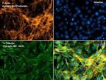 Phalloidin Control in Immunocytochemistry (ICC/IF)