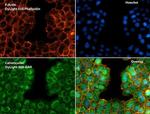 Phalloidin Control in Immunocytochemistry (ICC/IF)