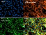 Phalloidin Control in Immunocytochemistry (ICC/IF)