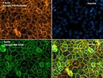 Phalloidin Control in Immunocytochemistry (ICC/IF)