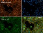 Phalloidin Control in Immunocytochemistry (ICC/IF)