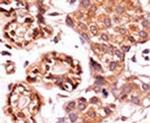Phospho-c-Abl (Tyr412) Antibody in Immunohistochemistry (IHC)