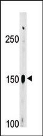 Phospho-c-Abl (Tyr412) Antibody in Western Blot (WB)