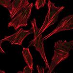 Phospho-ATF2 (Thr71) Antibody in Immunocytochemistry (ICC/IF)