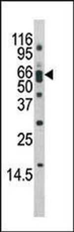 Phospho-BACE1 (Ser498) Antibody in Western Blot (WB)