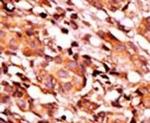 Phospho-BAD (Ser134) Antibody in Immunohistochemistry (IHC)