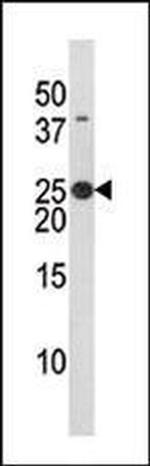 Phospho-BAD (Ser134) Antibody in Western Blot (WB)