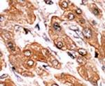Phospho-BIK (Thr33) Antibody in Immunohistochemistry (IHC)