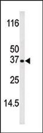 Phospho-BIK (Thr33) Antibody in Western Blot (WB)