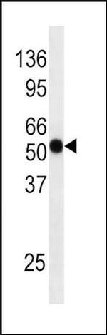 Phospho-Cdc25A (Ser124) Antibody in Western Blot (WB)