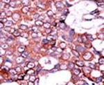 Phospho-Cdc25A (Ser75) Antibody in Immunohistochemistry (IHC)