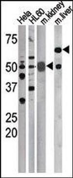 Phospho-Cdc25A (Ser75) Antibody in Western Blot (WB)