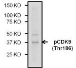 Phospho-CDK9 (Thr186) Polyclonal Antibody