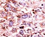 Phospho-CHK1 (Ser280) Antibody in Immunohistochemistry (IHC)