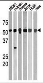 Phospho-CHK1 (Ser280) Antibody in Western Blot (WB)