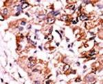 Phospho-CHK1 (Ser317) Antibody in Immunohistochemistry (IHC)