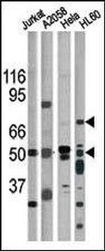 Phospho-CHK1 (Ser317) Antibody in Western Blot (WB)